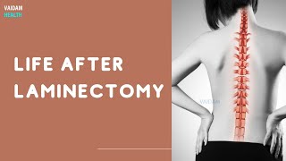 Life After Laminectomy