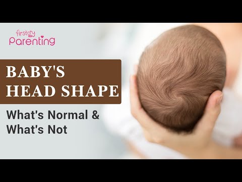 Baby's Head Shape - What's Normal and What's Not?