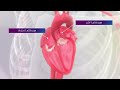 Left Atrial Appendage Occluders Reduce Risk Of Stroke In AFib Patients