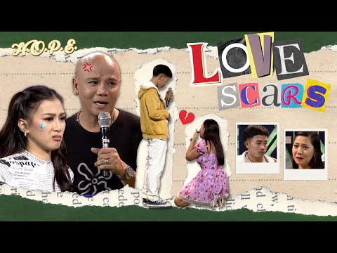 HOPE | Takot na akong masugatan! 🥺