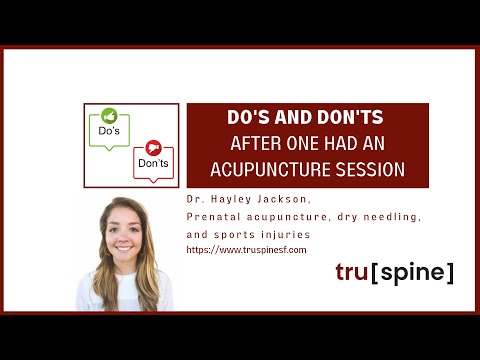 Do's and Don'ts after one had an acupuncture session