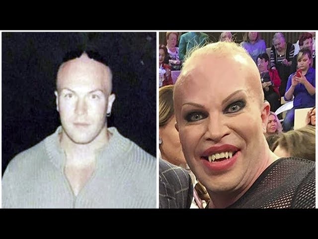 sddefault Как выглядел шпак до пластики