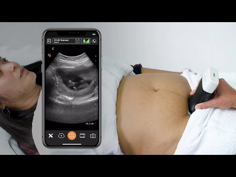 First Trimester Intrauterine Pregnancy: Ultrasound Scanning Technique