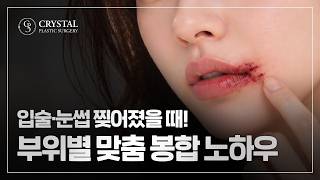 크리스탈성형외과 유튜브 영상