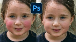 Photoshop Trick: Remove Red Patches Easily in Photoshop! Skin Color Matching Tips