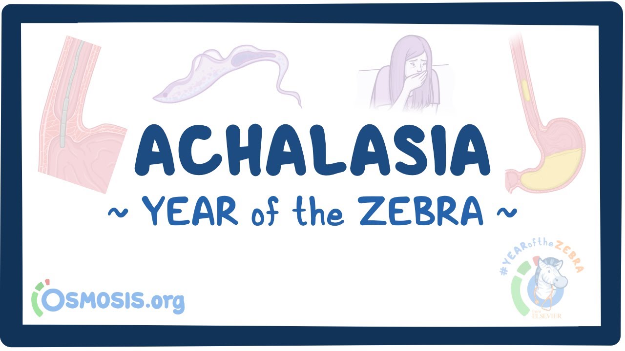 Achalasia (Year of the Zebra)