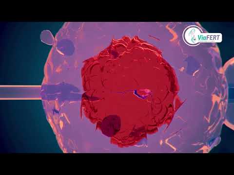 Comprehensive Guide to Timed Intercourse Fertility Treatment in Mexico