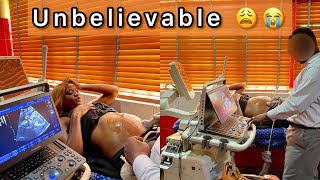 RAW* GENDER Review Ultrasound SCAN | Unexpected Gender review