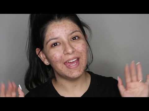 download lagu mp3 mp4 What Is Dermablend, download lagu What Is Dermablend gratis, unduh video klip What Is Dermablend