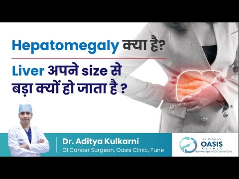 Why does the liver become bigger than its size? | What is Hepatomegaly? | Dr. Aditya Kulkarni