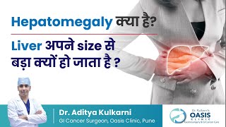 Why does the liver become bigger than its size | What is Hepatomegaly | Dr. Aditya Kulkarni