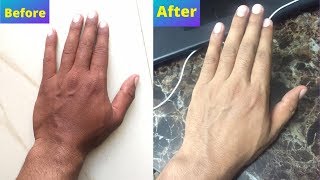 how to get your original skin color back - skin whitening home remedies