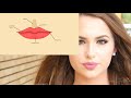 Lip Fillers 101 What You Need To Know