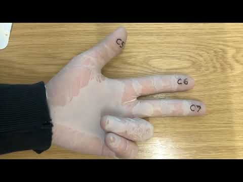 A physical mnemonic for remembering the root values of the terminal branches of the brachial plexus