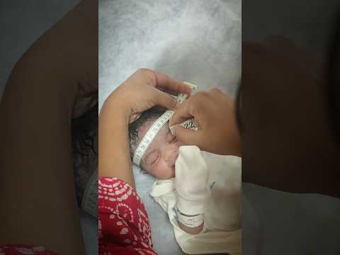 What No One Tells You About Measuring Head Size at Birth! #shorts