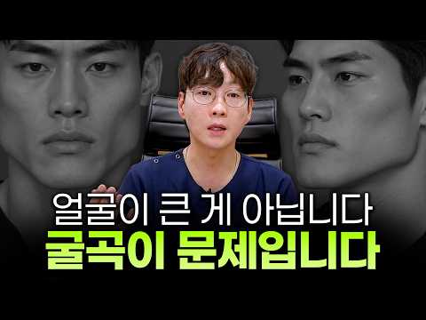 뼈를 무작정 깎지 않고 단점만 지워내는 남자 사각턱 광대 수술! ㅣ디에이성형외과ㅣ인상개선골격재배치