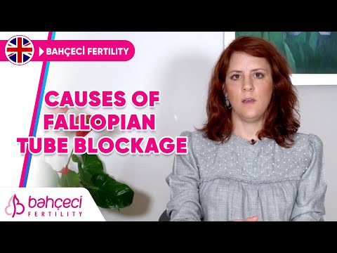 What Are The Causes of Blocked Fallopian Tubes?