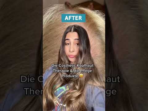 Was hilft gegen Rötungen auf der Kopfhaut? #haarpflegetipps #haarausfall #haarpflege