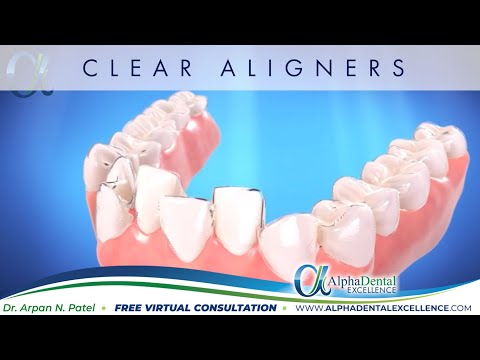 Alpha Dental Excellence - Customer Success Story
