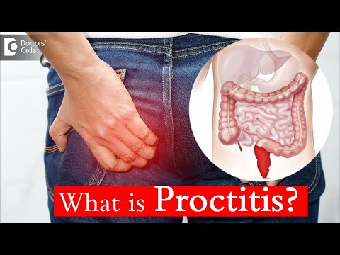 Proctitis: Causes, Treatment, and Surgery - Dr. Rajasekhar M R | Doctors' Circle