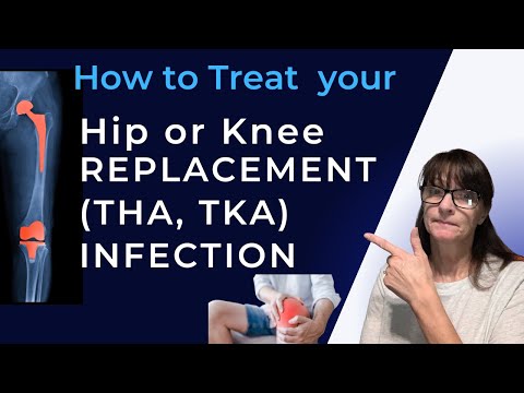 How to Treat Your Hip or Knee Replacement (THA, TKA) Infection