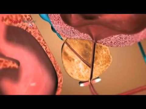 A QUOI SERT LA PROSTATE