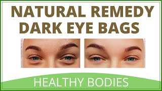 How To Remove Eye Bags Using Natural Remedies