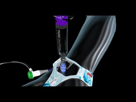 Angiography Pack