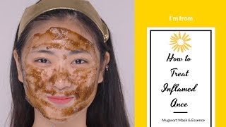 How to Treat Inflamed Ance | I'm from