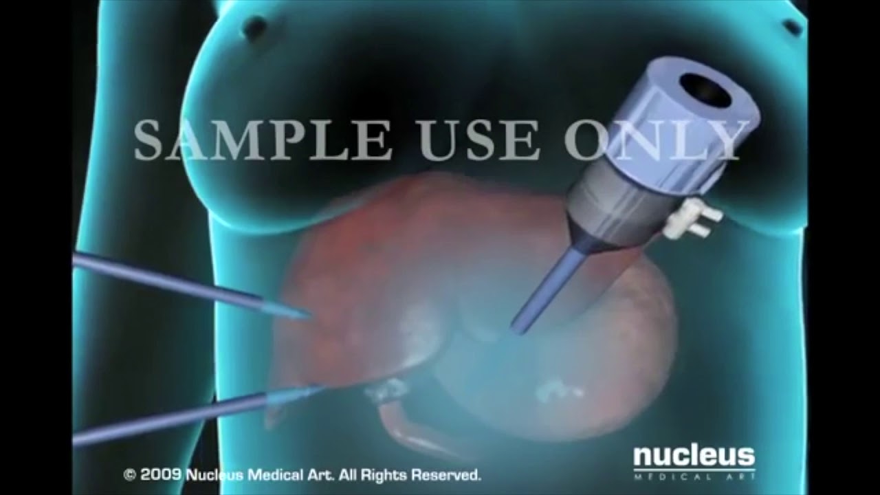 César Felipe Ploneda Valencia-19