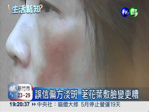 偏方淡斑.廉價換膚 過敏差點爛臉