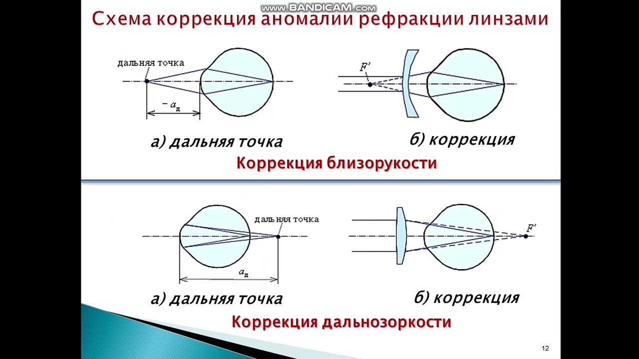 Приборы и устройства для проверки, коррекции и защиты зрения