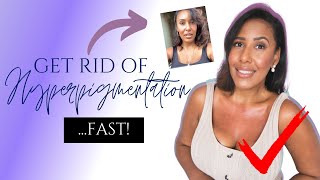 Get Rid of Hyperpigmentation, Scars, Dark Spots & Boil Scars on Your CHEST FAST | Microderm At Home