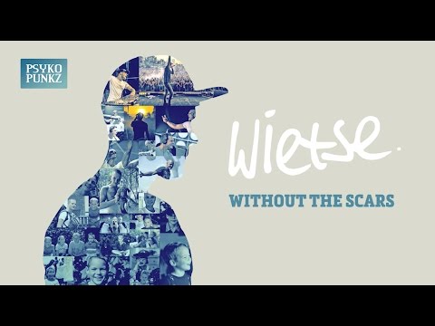 Video thumbnail for Without The Scars