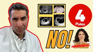 🤷‍♀️Cómo es un #embarazo no evolutivo: 4 señales⭐  ✅Dr. Felix Lugo 🥇😀