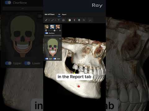 SMARTDent : 5D Tutorial #1-5. Screenshot