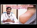 குழந்தைகளை வேர்க்குறுவில் இருந்து க�