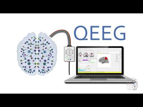 QEEG Explained - How Does A QEEG Brain Scan Work? - YouTube
