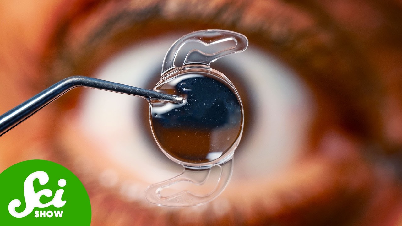 The Plane Crash That Gave Us Cataract Surgery