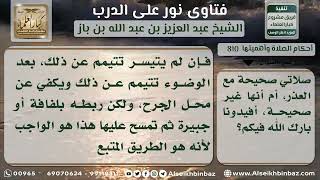 صورة 810 - حكم الصلاة مع عدم غسل مكان الجرح ونزول الدم منه - نور على الدرب