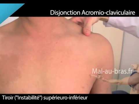 comment soigner entorse acromio claviculaire