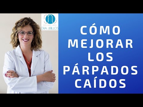 CÓMO MEJORAR LOS PÁRPADOS CAÍDOS