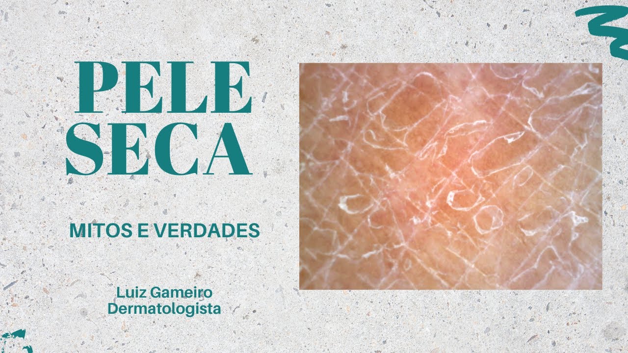 Pele Seca: Mitos e Verdades | Com Luiz Gameiro, dermatologista