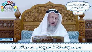 86 - هل تصح الصلاة إذا خرج دم يسير من الإنسان؟ - عثمان الخميس