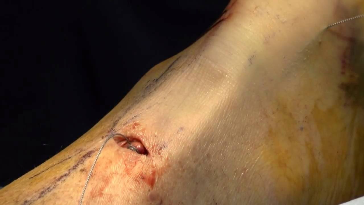 Javier De La Fuente Ortiz De Zarate-1