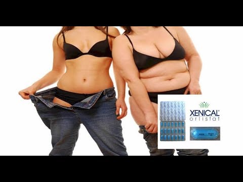 Kung gaano karaming mga prutas at gulay ay dapat na kinakain sa bawat araw upang mawalan ng timbang Brown liquid slimming presyo sa Ukraine curve sungay