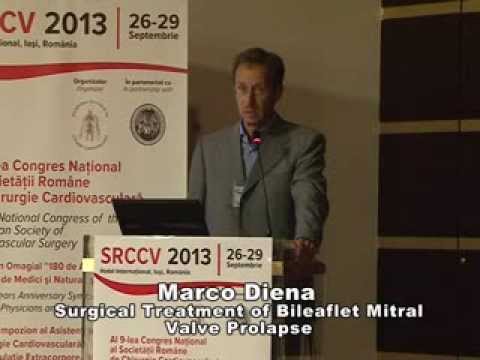 Marco Diena, Surgical Treatment of Bileaflet Mitral Valve Prolapse
