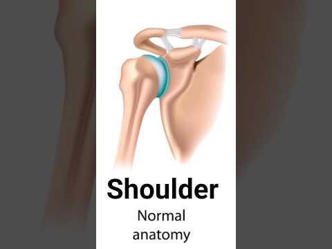 Shoulder Dislocation Types:  #shorts #short