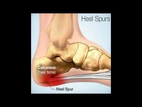 Mal di testa nei templi e la nuca Ci può essere un nodo alla gola con osteocondrosi della colonna cervicale