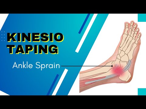How to Apply kinesiology Tape for an Ankle Inversion Sprain